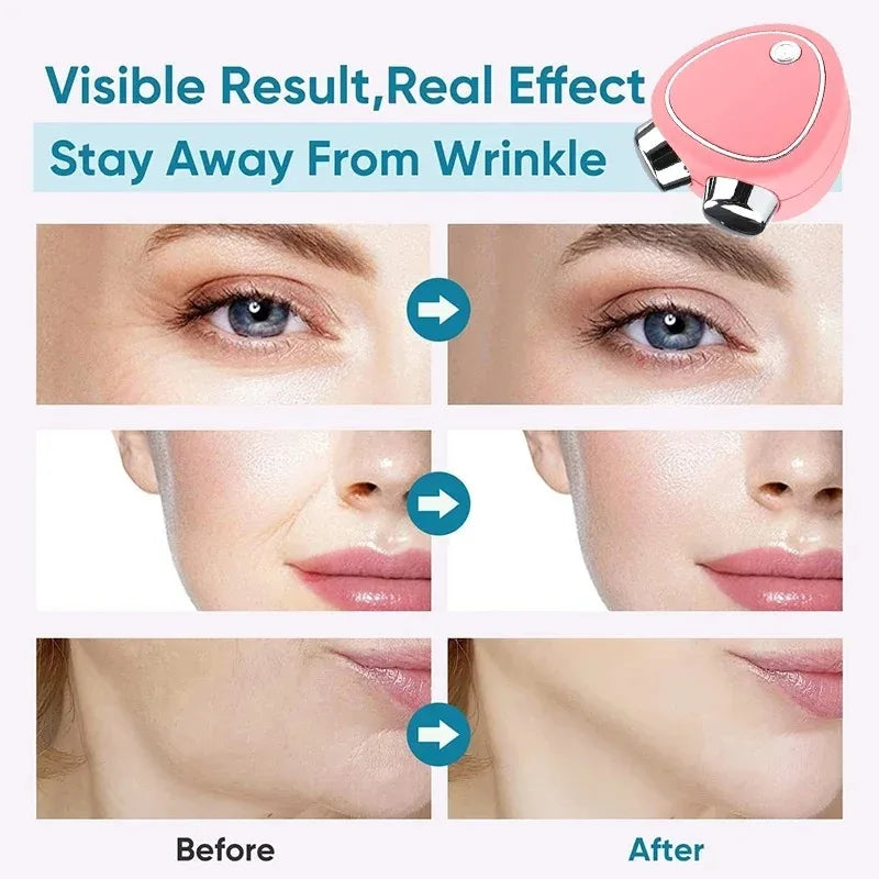 Anti wrinkle face firming lift